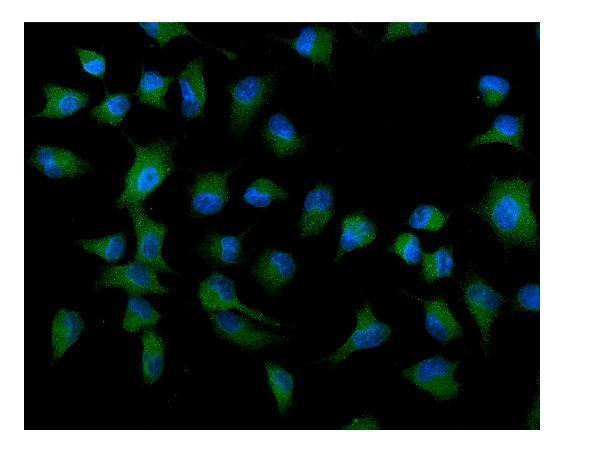  IF analysis of ATG9A using anti-ATG9A antibody (A03757-2)