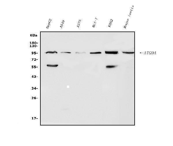  Western blot analysis of ATG9A using anti-ATG9A antibody (A03757-2)
