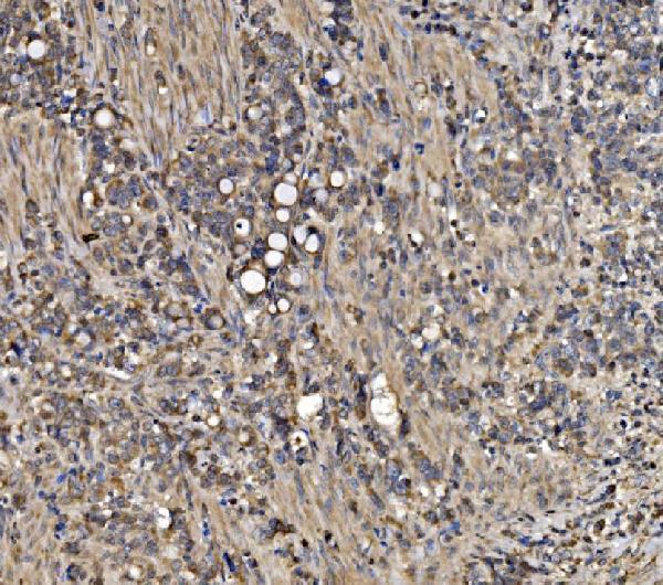 a03757 3 atg9a primary antibodies ihc testing 3
