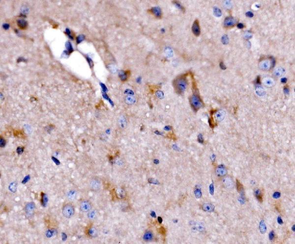 a03757 3 atg9a primary antibodies ihc testing 5