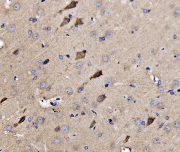 a03757 3 atg9a primary antibodies ihc testing 6