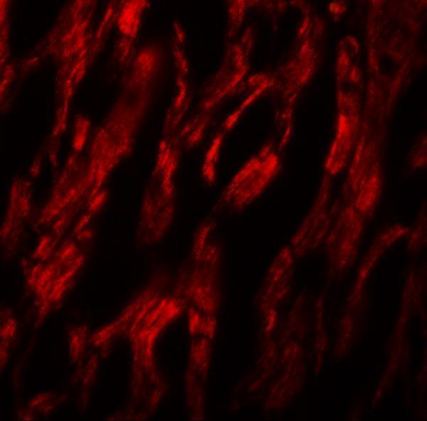 Immunofluorescence of ATG9A in human heart tissue with ATG9A antibody at 20 μg/mL