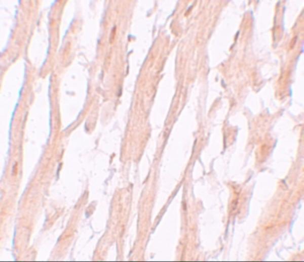 Immunohistochemistry of ATG9A in human heart tissue with ATG9A antibody at 5 μg/mL