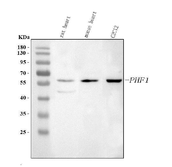  Western blot analysis of PHF1 using anti-PHF1 antibody (A03758-2)