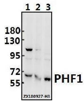 a03758 phf1 primary antiboties wb testing 1
