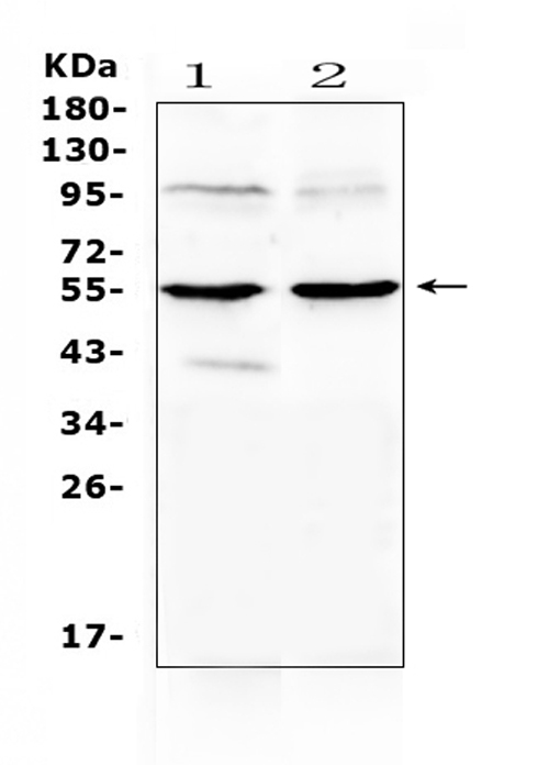 Western blot analysis of MMP10 using anti-MMP10 antibody (A03759-1). Electrophoresis was performed on a 5-20% SDS-PAGE gel at 70V (Stacking gel) / 90V (Resolving gel) for 2-3 hours. The sample well of each lane was loaded with 50ug of sample under reducing conditions. Lane 1: rat cardiac muscle tissue lysates, Lane 2: mouse cardiac muscle tissue lysates. After Electrophoresis, proteins were transferred to a Nitrocellulose membrane at 150mA for 50-90 minutes. Blocked the membrane with 5% Non-fat Milk/ TBS for 1.5 hour at RT. The membrane was incubated with rabbit anti-MMP10 antigen affinity purified polyclonal antibody (Catalog # A03759-1) at 0.5 μg/mL overnight at 4°C, then washed with TBS-0.1%Tween 3 times with 5 minutes each and probed with a goat anti-rabbit IgG-HRP secondary antibody at a dilution of 1:10000 for 1.5 hour at RT. The signal is developed using an Enhanced Chemiluminescent detection (ECL) kit (Catalog # EK1002) with Tanon 5200 system. A specific band was detected for MMP10 at approximately 54KD. The expected band size for MMP10 is at 54KD.