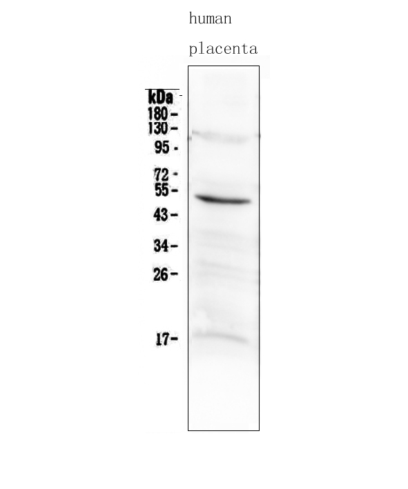 Western blot analysis of MMP10 using anti-MMP10 antibody (A03759-1). Electrophoresis was performed on a 5-20% SDS-PAGE gel at 70V (Stacking gel) / 90V (Resolving gel) for 2-3 hours. The sample well of each lane was loaded with 50ug of sample under reducing conditions. Lane 1: human placenta tissue lysates. After Electrophoresis, proteins were transferred to a Nitrocellulose membrane at 150mA for 50-90 minutes. Blocked the membrane with 5% Non-fat Milk/ TBS for 1.5 hour at RT. The membrane was incubated with rabbit anti-MMP10 antigen affinity purified polyclonal antibody (Catalog # A03759-1) at 0.5 μg/mL overnight at 4°C, then washed with TBS-0.1%Tween 3 times with 5 minutes each and probed with a goat anti-rabbit IgG-HRP secondary antibody at a dilution of 1:10000 for 1.5 hour at RT. The signal is developed using an Enhanced Chemiluminescent detection (ECL) kit (Catalog # EK1002) with Tanon 5200 system. A specific band was detected for MMP10 at approximately 54KD. The expected band size for MMP10 is at 54KD.