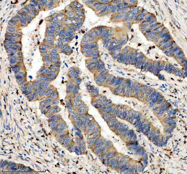 IHC analysis of RTN3 using anti-RTN3 antibody (A03760)