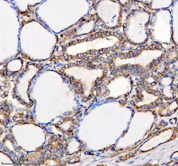IHC analysis of RTN3 using anti-RTN3 antibody (A03760)