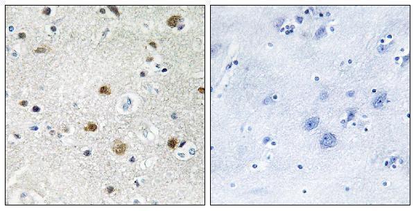 Immunohistochemistry analysis of paraffin-embedded human brain tissue, using TF3B Antibody