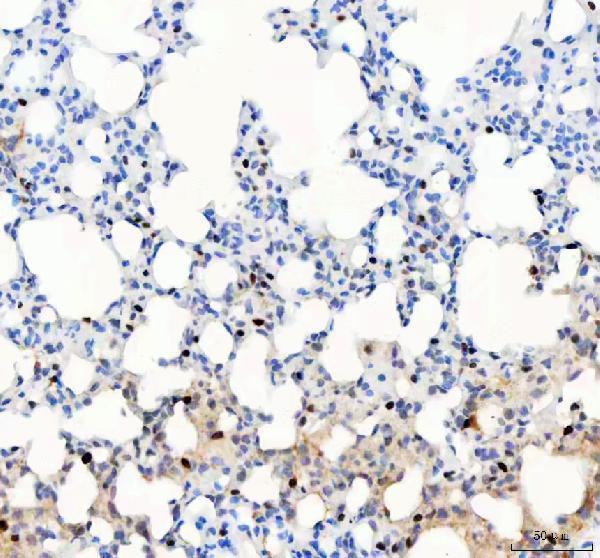  IHC analysis of PARP3 using anti-PARP3 antibody (A03762-2)