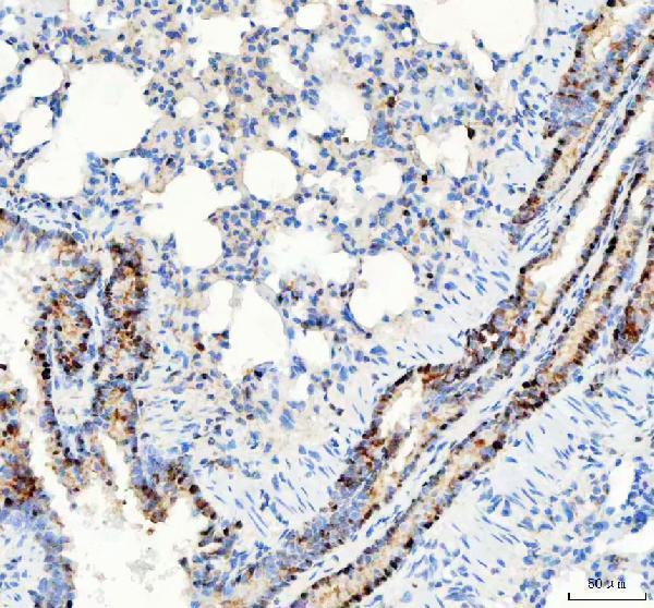  IHC analysis of PARP3 using anti-PARP3 antibody (A03762-2)