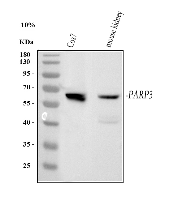  Western blot analysis of PARP3 using anti-PARP3 antibody (A03762-2)