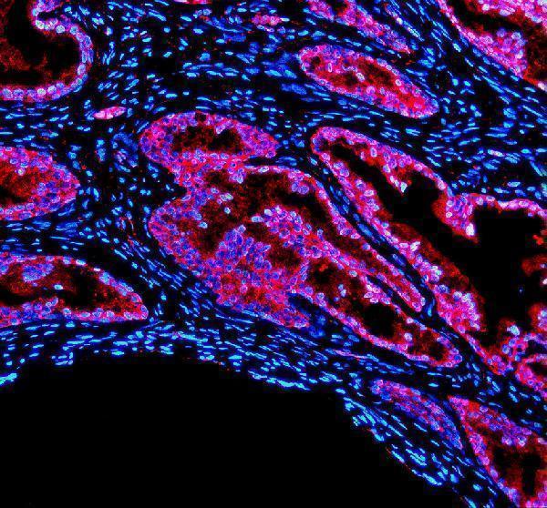 IF analysis of PDLIM5 using anti-PDLIM5 antibody (A03763-1)