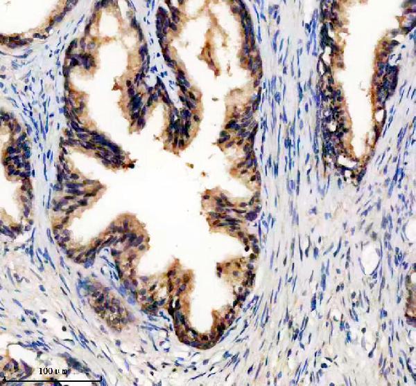 IHC analysis of PDLIM5 using anti-PDLIM5 antibody (A03763-1)
