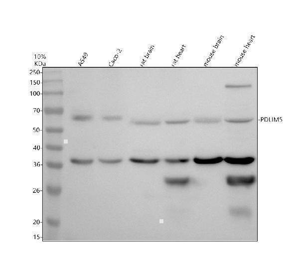 Western blot analysis of PDLIM5 using anti-PDLIM5 antibody (A03763-1)