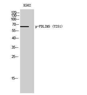 Western Blot analysis of K562 cells using Phospho-PDLIM5 (Y251) Polyclonal Antibody