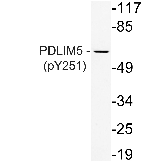 Western blot analysis of lysate from K562 cells, uisng phospho-PDLIM5 (Phospho-Tyr251) antibody