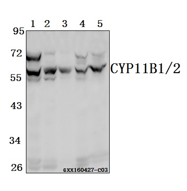 a03766 cyp11b1 primary antiboties wb testing 1