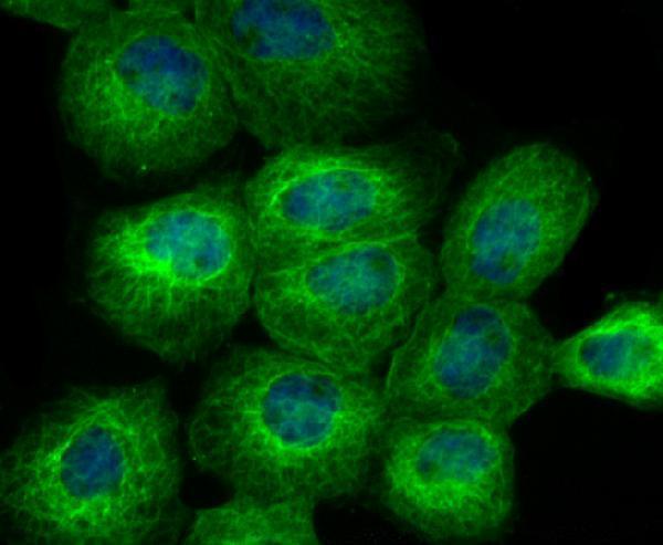 ICC staining BAP31 in A431 cells (green)