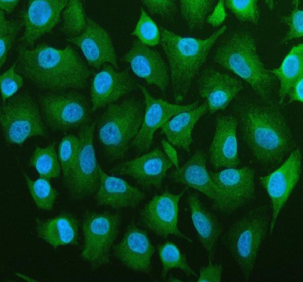 Figure 8. IF analysis of BAP31/BCAP31 using anti-BAP31/BCAP31 antibody (A03767-4). BAP31/BCAP31 was detected in an immunocytochemical section of A549 cells. Enzyme antigen retrieval was performed using IHC enzyme antigen retrieval reagent (AR0022) for 15 mins. The cells were blocked with 10% goat serum. And then incubated with 5 microg/mL rabbit anti-BAP31/BCAP31 Antibody (A03767-4) overnight at 4°C. DyLight®488 Conjugated Goat Anti-Rabbit IgG (BA1127) was used as secondary antibody at 1:500 dilution and incubated for 30 minutes at 37°C. The section was counterstained with DAPI. Visualize using a fluorescence microscope and filter sets appropriate for the label used. Figure 8. IF analysis of BAP31/BCAP31 using anti-BAP31/BCAP31 antibody (A03767-4). BAP31/BCAP31 was detected in an immunocytochemical section of A549 cells. Enzyme antigen retrieval was performed using IHC enzyme antigen retrieval reagent (AR0022) for 15 mins. The cells were blocked with 10% goat serum. And then incubated with 5 microg/mL rabbit anti-BAP31/BCAP31 Antibody (A03767-4) overnight at 4°C. DyLight®488 Conjugated Goat Anti-Rabbit IgG (BA1127) was used as secondary antibody at 1:500 dilution and incubated for 30 minutes at 37°C. The section was counterstained with DAPI. Visualize using a fluorescence microscope and filter sets appropriate for the label used.