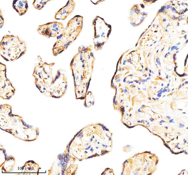 Figure 5. IHC analysis of BAP31/BCAP31 using anti-BAP31/BCAP31 antibody (A03767-4). BAP31/BCAP31 was detected in a paraffin-embedded section of human placenta tissue. Heat mediated antigen retrieval was performed in EDTA buffer (pH 8.0, epitope retrieval solution). The tissue section was blocked with 10% goat serum. The tissue section was then incubated with 2 microg/ml rabbit anti-BAP31/BCAP31 Antibody (A03767-4) overnight at 4°C. Peroxidase Conjugated Goat Anti-rabbit IgG was used as secondary antibody and incubated for 30 minutes at 37°C. The tissue section was developed using HRP Conjugated Rabbit IgG Super Vision Assay Kit (Catalog # SV0002) with DAB as the chromogen. Figure 5. IHC analysis of BAP31/BCAP31 using anti-BAP31/BCAP31 antibody (A03767-4). BAP31/BCAP31 was detected in a paraffin-embedded section of human placenta tissue. Heat mediated antigen retrieval was performed in EDTA buffer (pH 8.0, epitope retrieval solution). The tissue section was blocked with 10% goat serum. The tissue section was then incubated with 2 microg/ml rabbit anti-BAP31/BCAP31 Antibody (A03767-4) overnight at 4°C. Peroxidase Conjugated Goat Anti-rabbit IgG was used as secondary antibody and incubated for 30 minutes at 37°C. The tissue section was developed using HRP Conjugated Rabbit IgG Super Vision Assay Kit (Catalog # SV0002) with DAB as the chromogen.