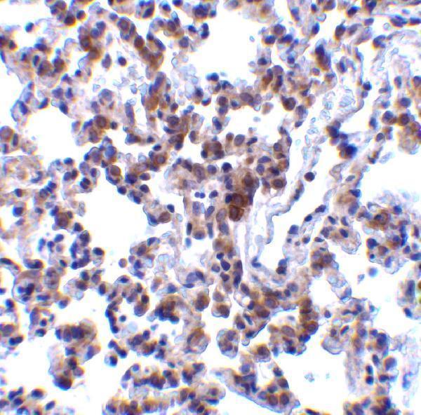 a03767 bcap31 primary antibodies ihc testing 4