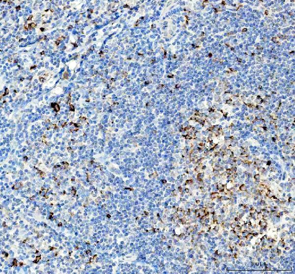 Figure 4. IHC analysis of VPAC2/VIPR2 using anti-VPAC2/VIPR2 antibody (A03768-1). VPAC2/VIPR2 was detected in a paraffin-embedded section of human tonsil tissue. Heat mediated antigen retrieval was performed in EDTA buffer (pH 8.0, epitope retrieval solution). The tissue section was blocked with 10% goat serum. The tissue section was then incubated with 2 microg/ml rabbit anti-VPAC2/VIPR2 Antibody (A03768-1) overnight at 4°C. Peroxidase Conjugated Goat Anti-rabbit IgG was used as secondary antibody and incubated for 30 minutes at 37°C. The tissue section was developed using HRP Conjugated Rabbit IgG Super Vision Assay Kit (Catalog # SV0002) with DAB as the chromogen. Figure 4. IHC analysis of VPAC2/VIPR2 using anti-VPAC2/VIPR2 antibody (A03768-1). VPAC2/VIPR2 was detected in a paraffin-embedded section of human tonsil tissue. Heat mediated antigen retrieval was performed in EDTA buffer (pH 8.0, epitope retrieval solution). The tissue section was blocked with 10% goat serum. The tissue section was then incubated with 2 microg/ml rabbit anti-VPAC2/VIPR2 Antibody (A03768-1) overnight at 4°C. Peroxidase Conjugated Goat Anti-rabbit IgG was used as secondary antibody and incubated for 30 minutes at 37°C. The tissue section was developed using HRP Conjugated Rabbit IgG Super Vision Assay Kit (Catalog # SV0002) with DAB as the chromogen.