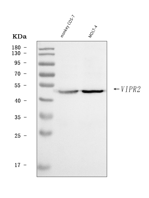 Figure 1. Western blot analysis of VPAC2/VIPR2 using anti-VPAC2/VIPR2 antibody (A03768-1). Electrophoresis was performed on a 5-20% SDS-PAGE gel at 70V (Stacking gel) / 90V (Resolving gel) for 2-3 hours. The sample well of each lane was loaded with 30 ug of sample under reducing conditions. Lane 1: monkey COS-7 whole cell lysates, Lane 2: human MOLT-4 whole cell lysates. After electrophoresis, proteins were transferred to a nitrocellulose membrane at 150 mA for 50-90 minutes. Blocked the membrane with 5% non-fat milk/TBS for 1.5 hour at RT. The membrane was incubated with rabbit anti-VPAC2/VIPR2 antigen affinity purified polyclonal antibody (Catalog # A03768-1) at 0.5 microg/mL overnight at 4°C, then washed with TBS-0.1%Tween 3 times with 5 minutes each and probed with a goat anti-rabbit IgG-HRP secondary antibody at a dilution of 1:5000 for 1.5 hour at RT. The signal is developed using an Enhanced Chemiluminescent detection (ECL) kit (Catalog # EK1002) with Tanon 5200 system. A specific band was detected for VPAC2/VIPR2 at approximately 49 kDa. The expected band size for VPAC2/VIPR2 is at 49 kDa.