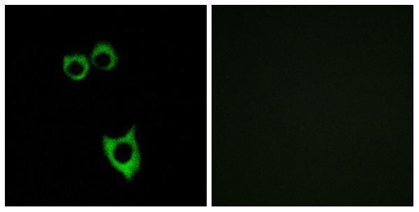 Immunofluorescence analysis of MCF7 cells, using VIPR2 Antibody