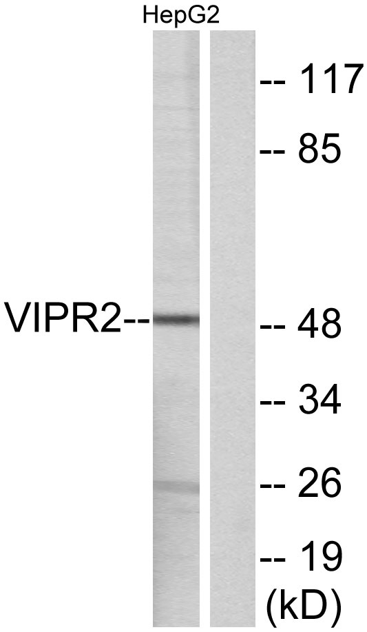 Western blot analysis of lysates from HepG2 cells, using VIPR2 Antibody