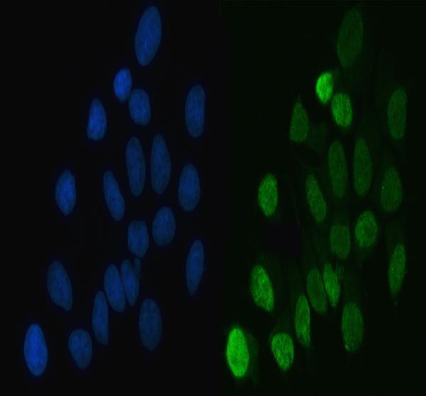 a03769 4 hnrnpl primary antibodies if testing 13_1