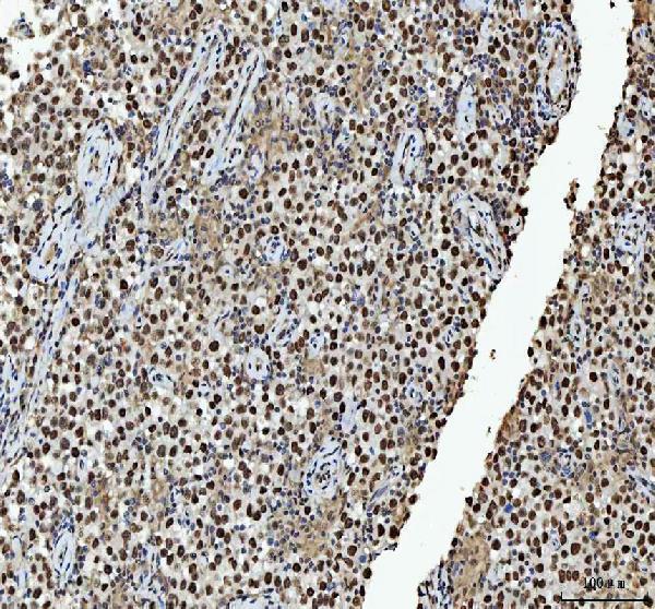 a03769 4 hnrnpl primary antibodies ihc testing 10_1