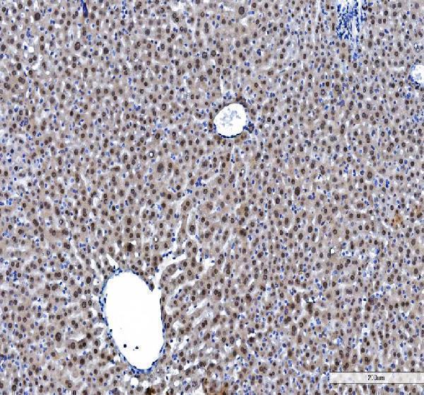 a03769 4 hnrnpl primary antibodies ihc testing 11_1