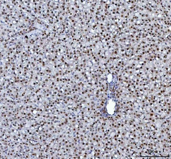 a03769 4 hnrnpl primary antibodies ihc testing 12_1
