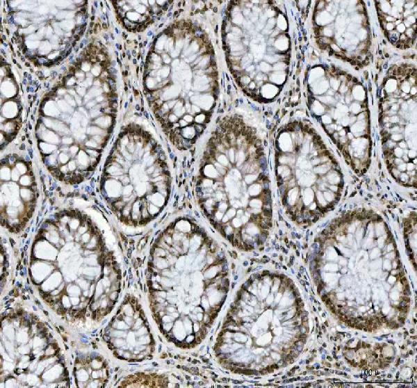  IHC analysis of hnRNP L/HNRNPL using anti-hnRNP L/HNRNPL antibody (A03769-4)