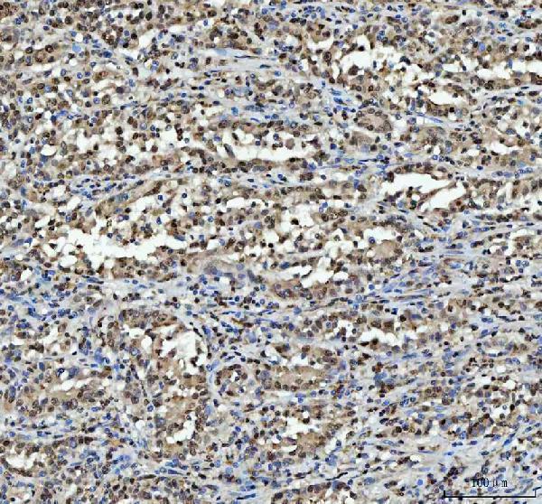 a03769 4 hnrnpl primary antibodies ihc testing 4_1