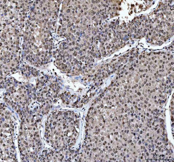 a03769 4 hnrnpl primary antibodies ihc testing 5_1