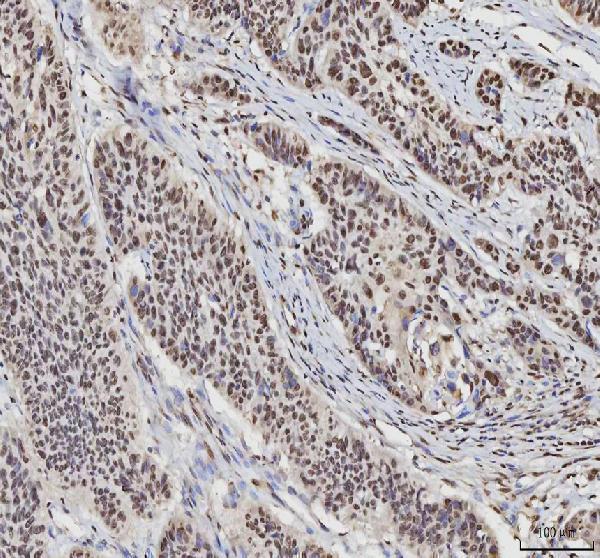 a03769 4 hnrnpl primary antibodies ihc testing 6_1