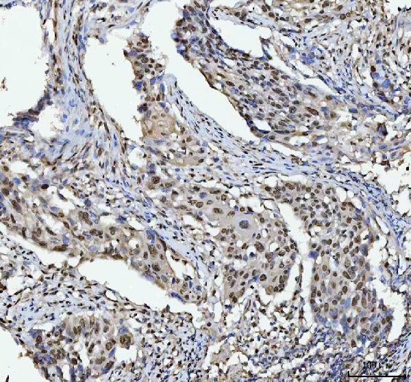 a03769 4 hnrnpl primary antibodies ihc testing 7_1