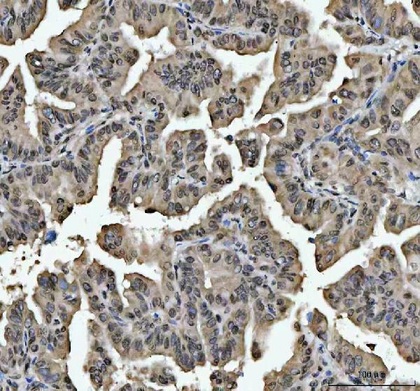 a03769 4 hnrnpl primary antibodies ihc testing 8_1