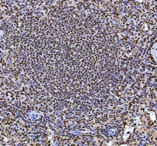 a03769 4 hnrnpl primary antibodies ihc testing 9_1