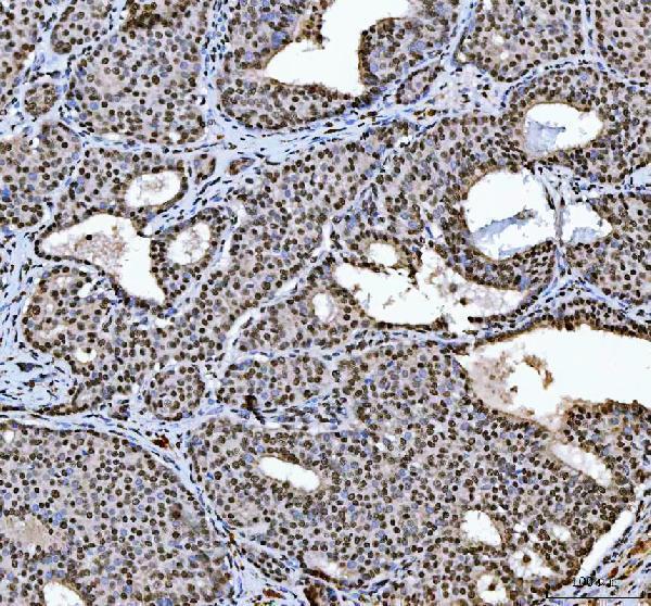 a03769 hnrnpl primary antibodies ihc testing 2