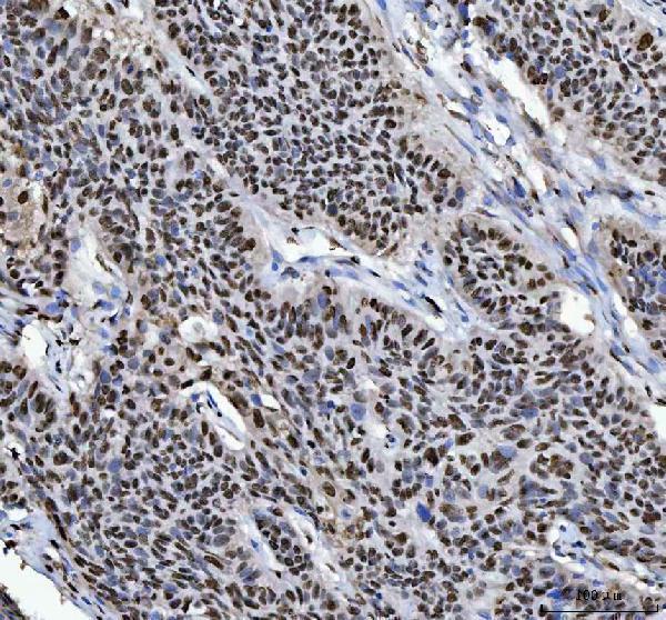a03769 hnrnpl primary antibodies ihc testing 4