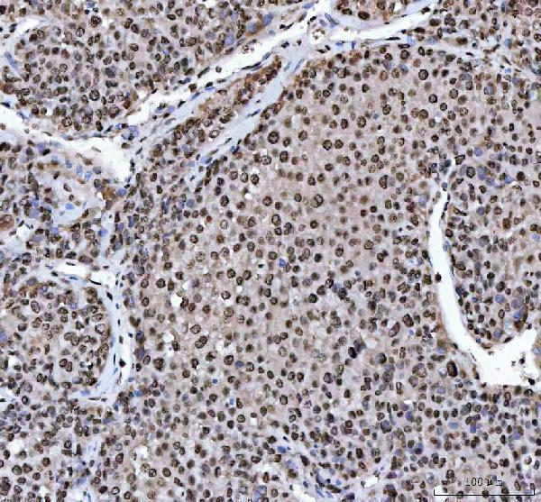 a03769 hnrnpl primary antibodies ihc testing 5