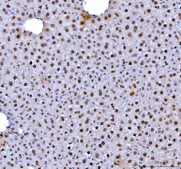 a03769 hnrnpl primary antibodies ihc testing 7
