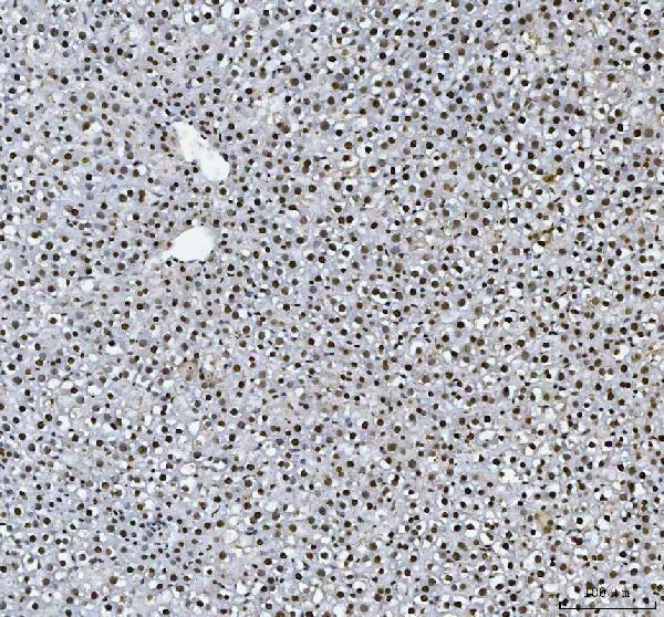 a03769 hnrnpl primary antibodies ihc testing 8