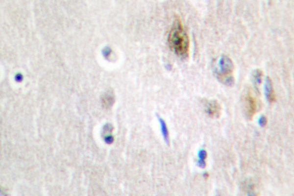 a03770 1 tra2a primary antiboties ihc testing 2