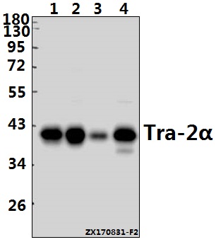 a03770 1 tra2a primary antiboties wb testing 1