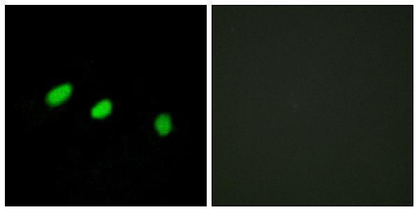 a03770 tra2a primary antibodies if testing 1